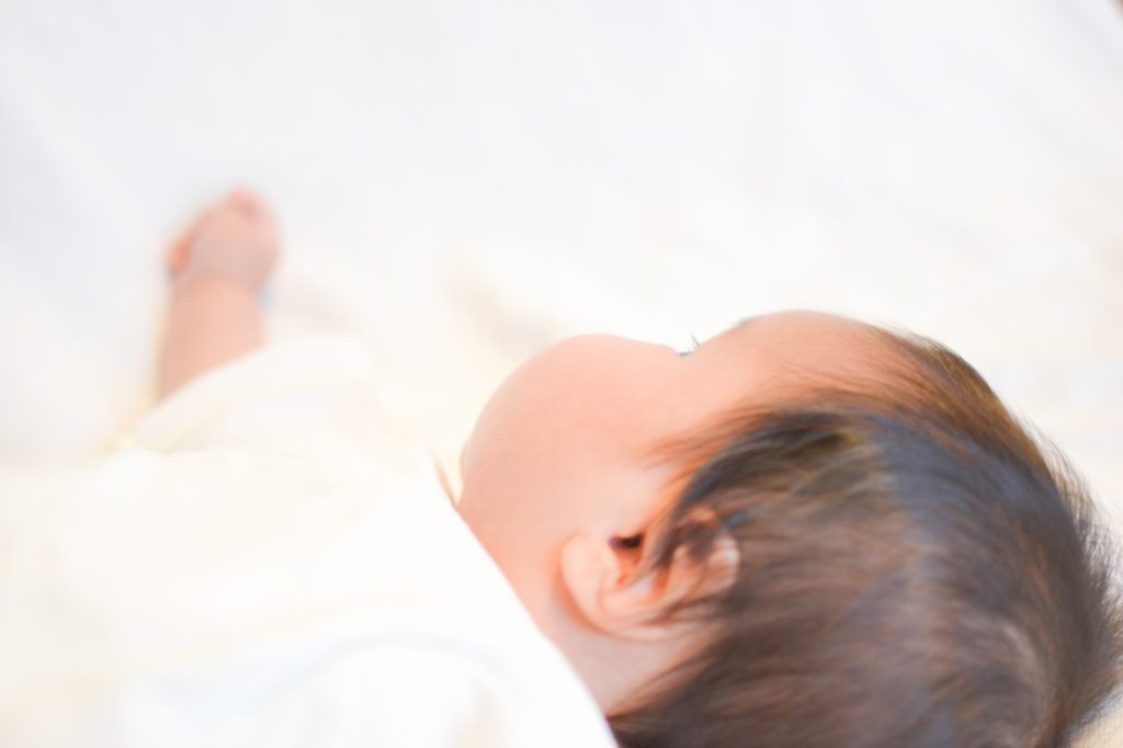 なぜ乳児脂漏性湿疹になるの？